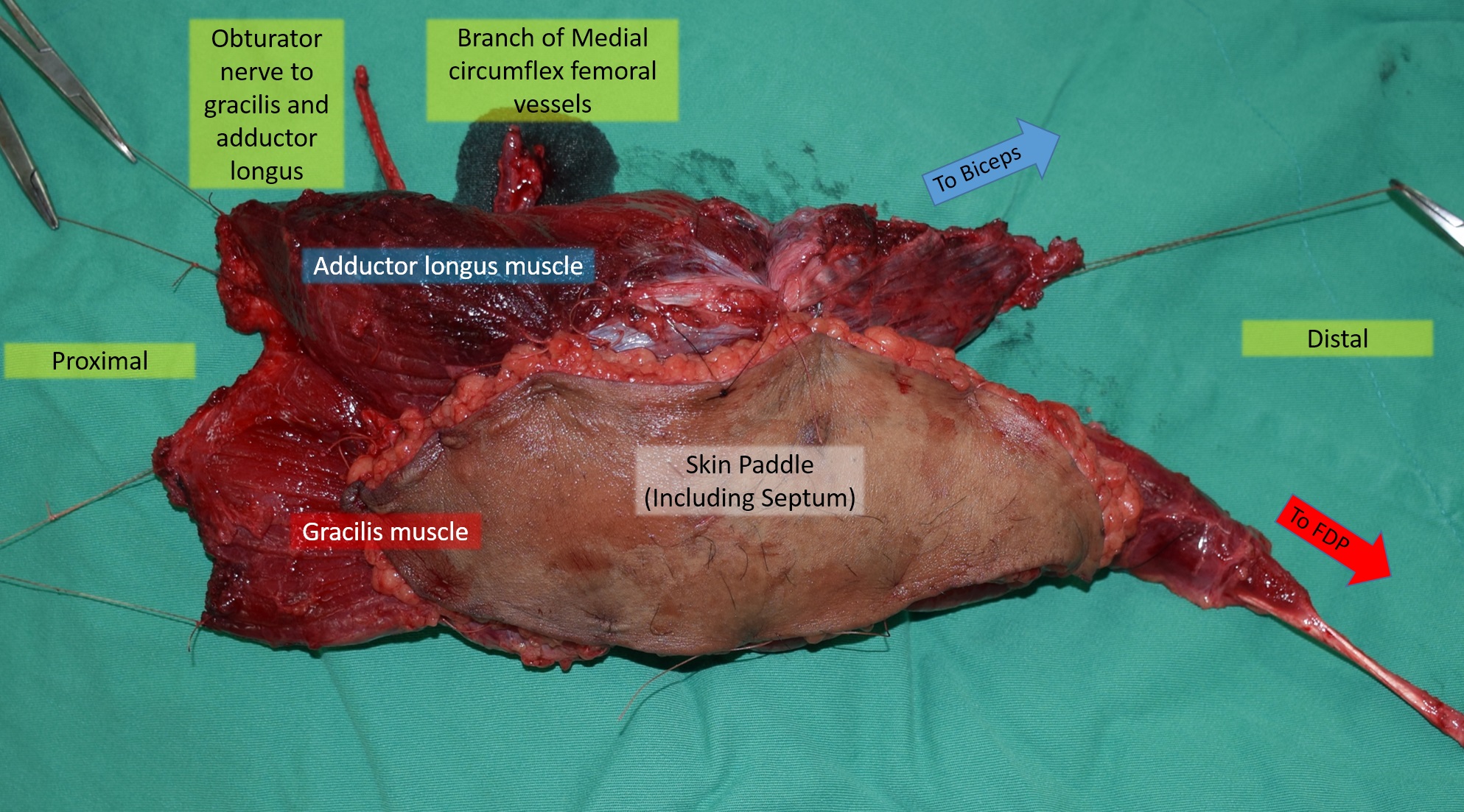 Figure 1.jpg